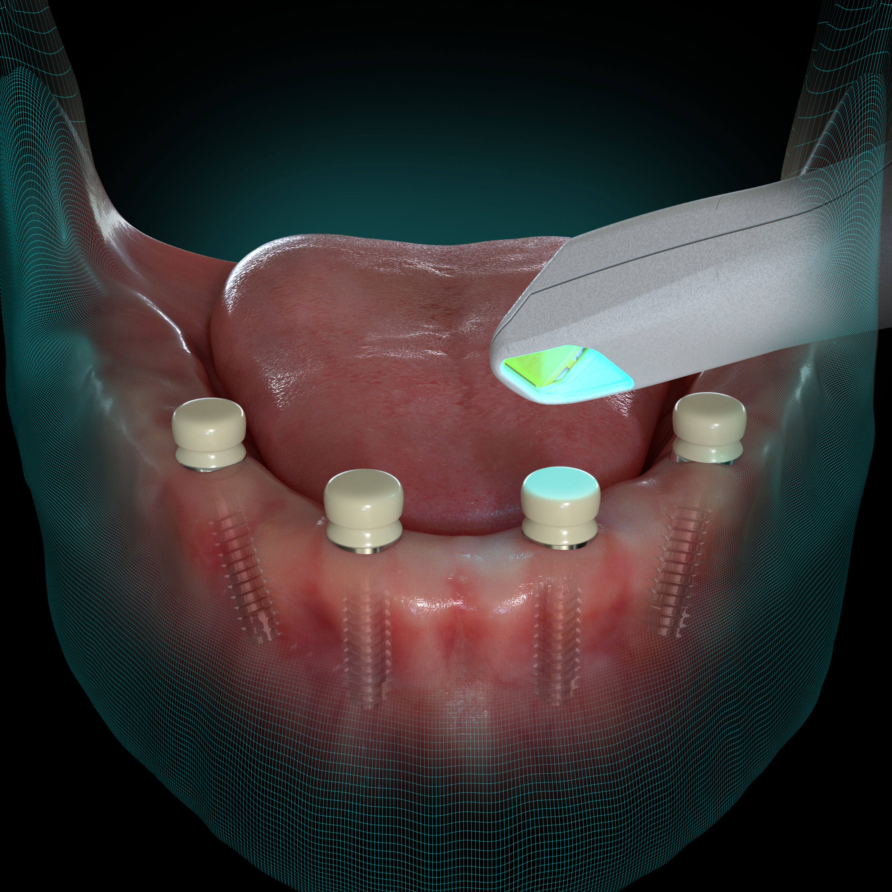 Digital Dentistry